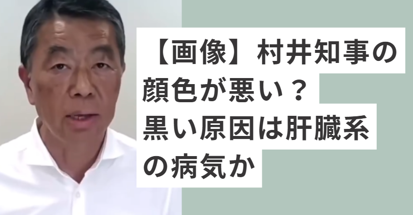 顔色が悪い村井知事